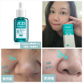 【Neogence霓淨思15% 6酸拋光嫩膚精華】溫和煥膚不乾癢好舒適透亮