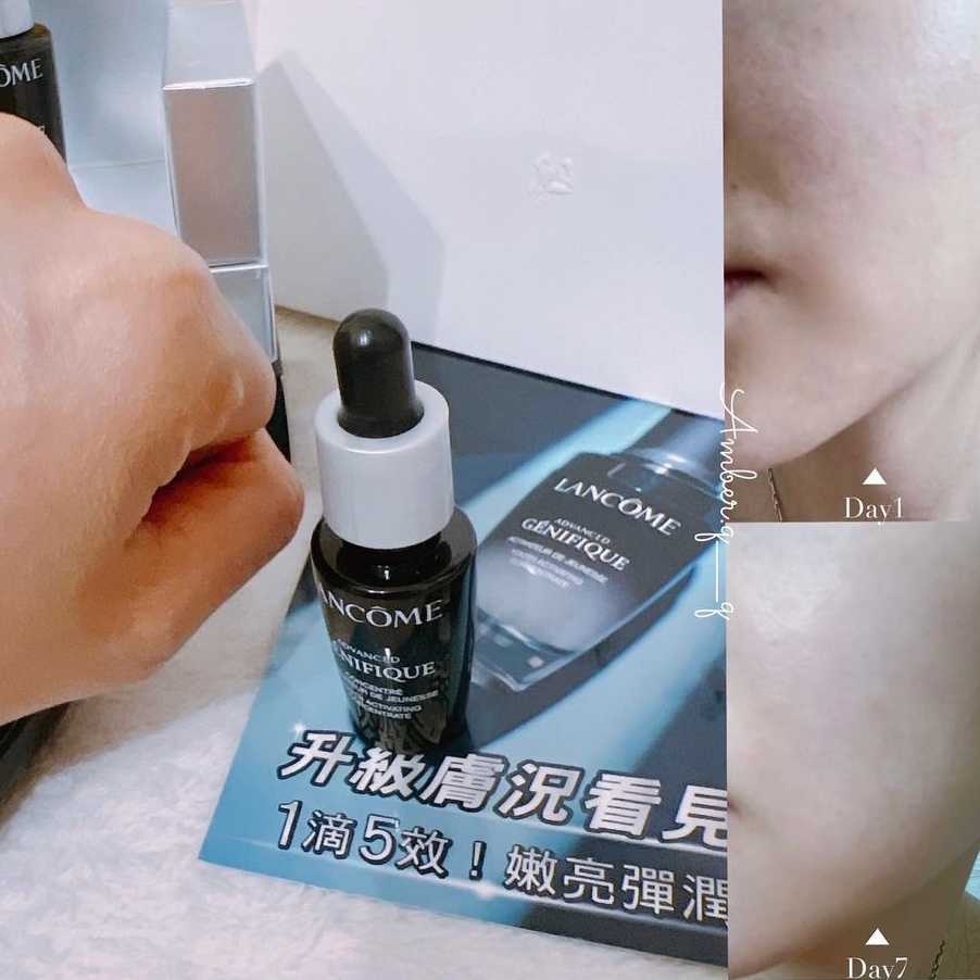 一起來用小黑瓶讓膚況登上新巔峰🥳