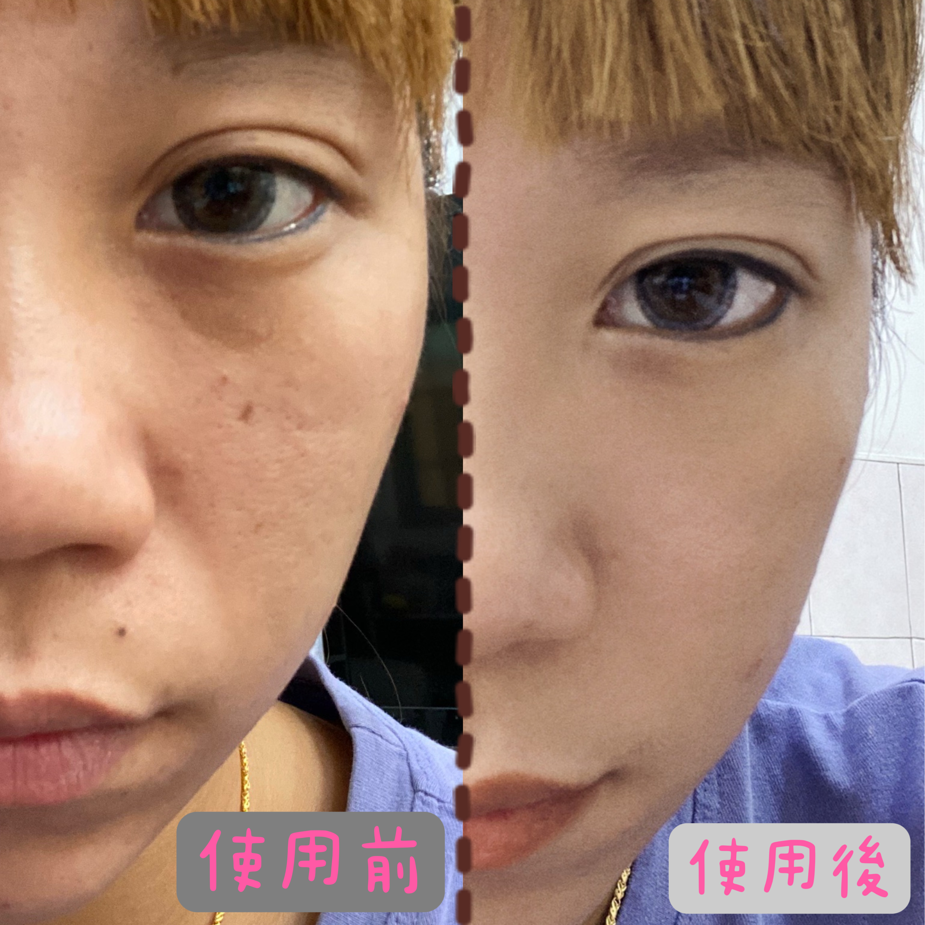 試用心得回填
