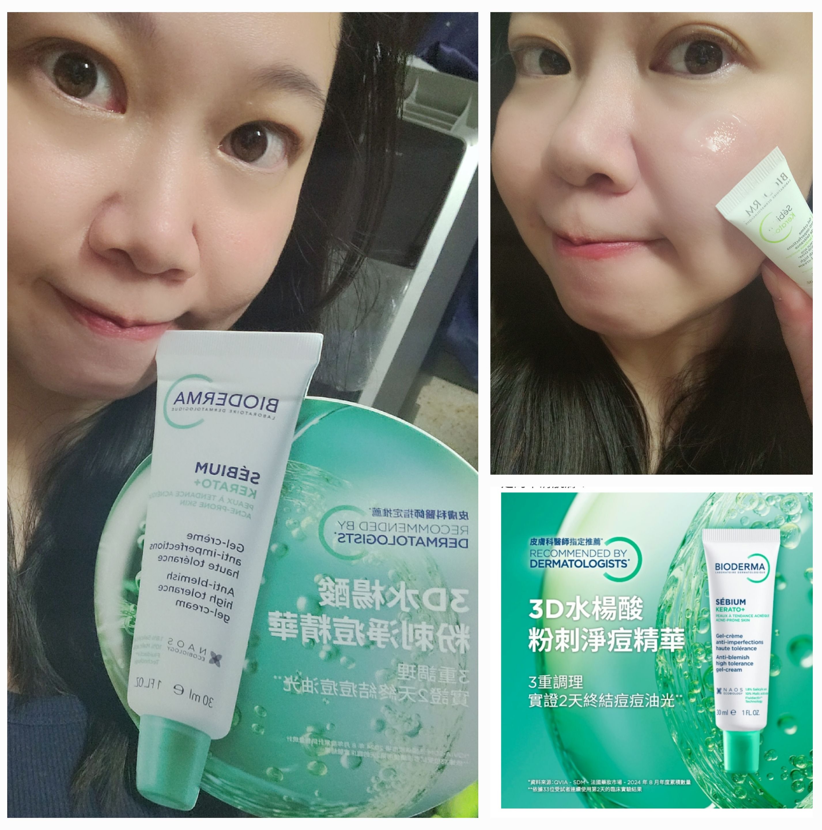 貝膚黛瑪3D水楊酸粉刺淨痘精華，滅痘王超推薦